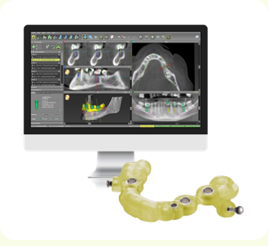 ストローマンガイドシステム